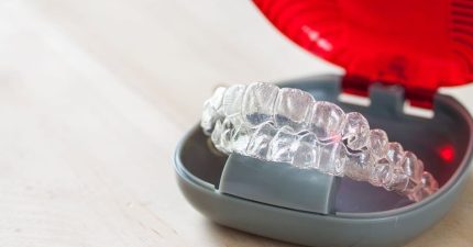 En qué consiste el Invisalign