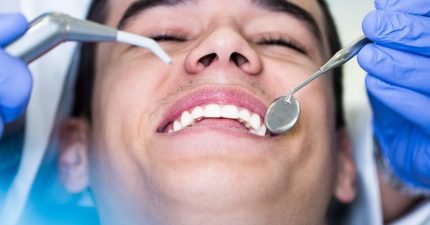 Cada cuánto hacerse una limpieza dental