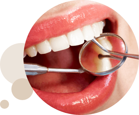 Limpieza dental Granada