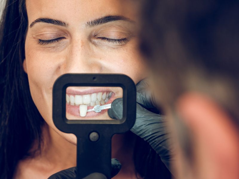 Lupa para ver los dientes para la realización de una carilla dental.