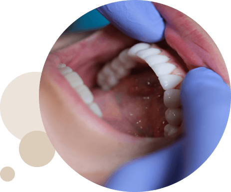 Cirugía maxilofacial en Granada