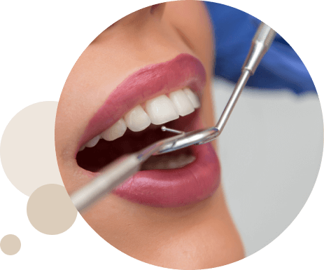 Estética dental en Granada