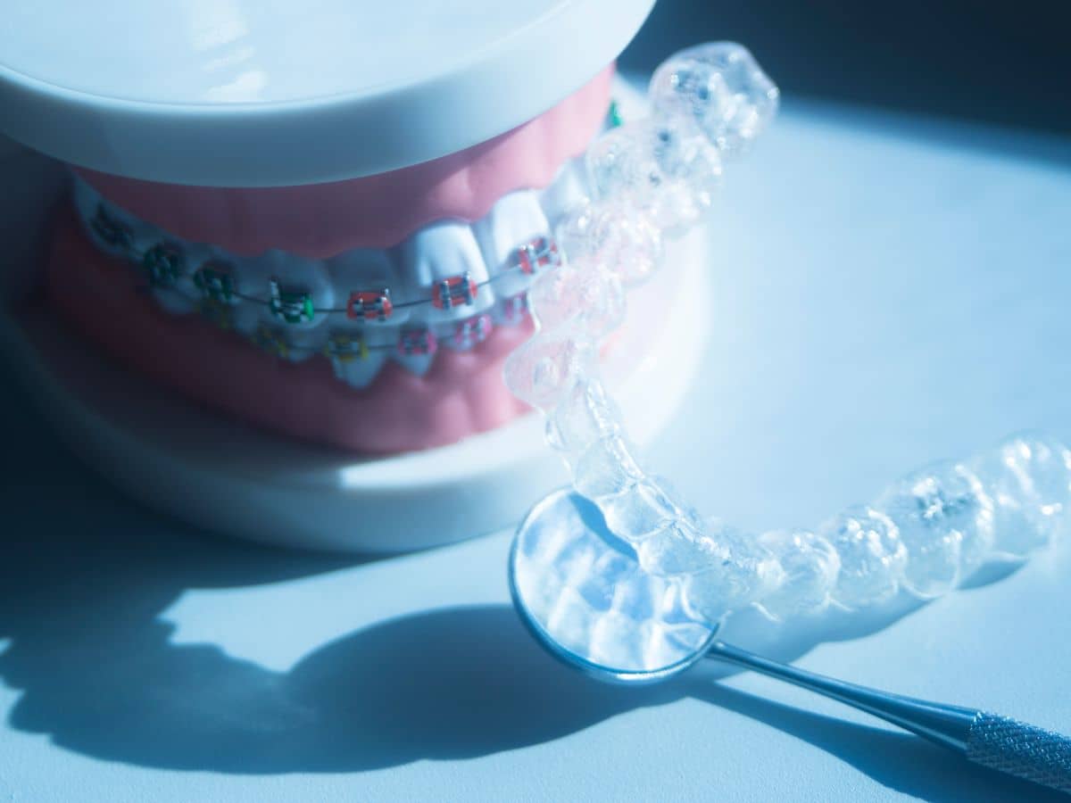 Costos los tratamientos brackets invisibles