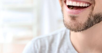 sonrisa dientes perfectos