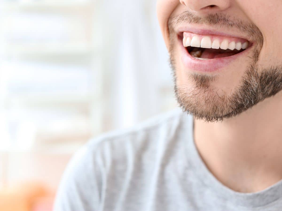 sonrisa dientes perfectos