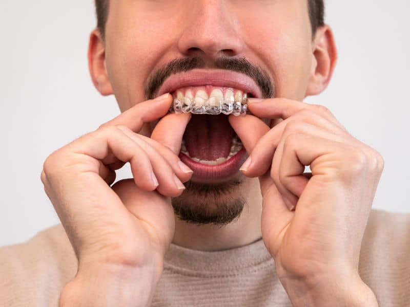 corrección dental