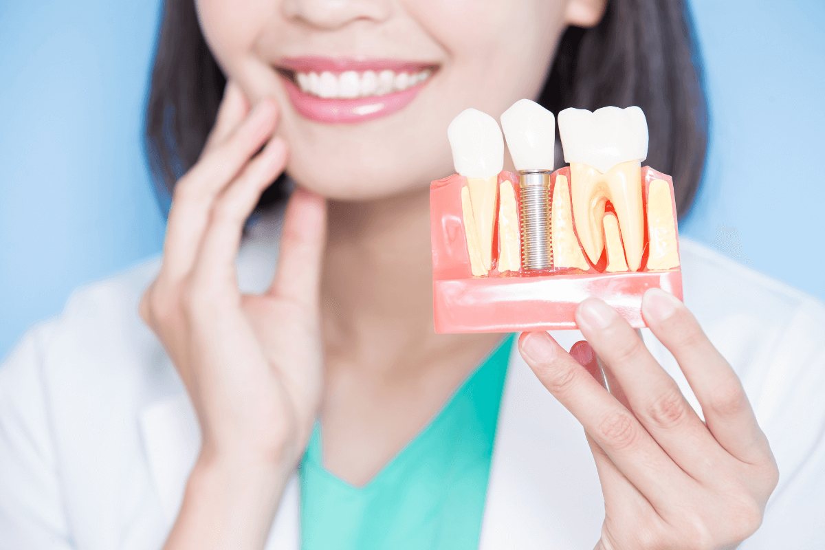 sonrisa implante dental